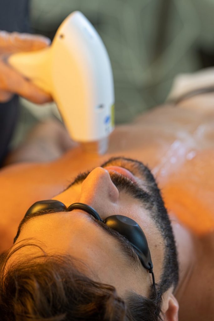 Epilação laser torax
