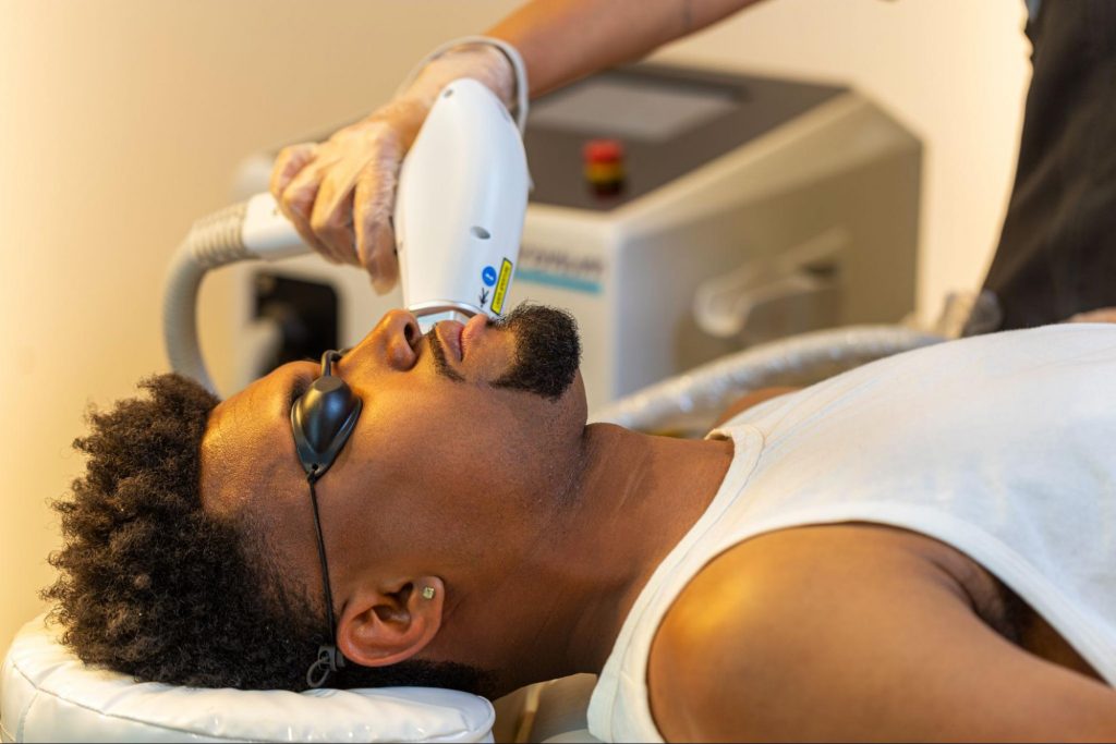 depilação; laser; pelo; remoção; homem; negro; depilação em pele negra