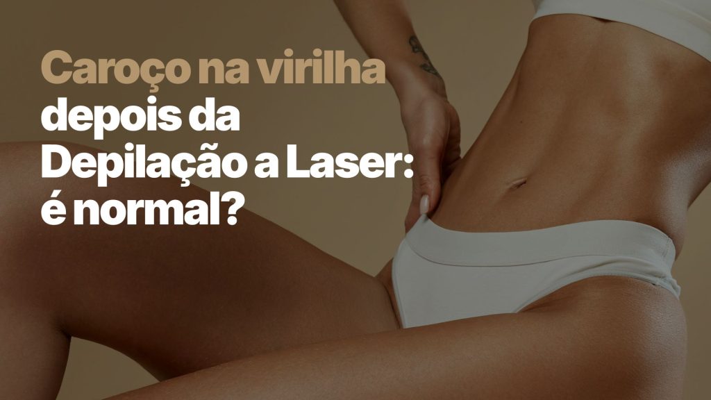 Mulher segurando a região da virilha após depilação a laser.