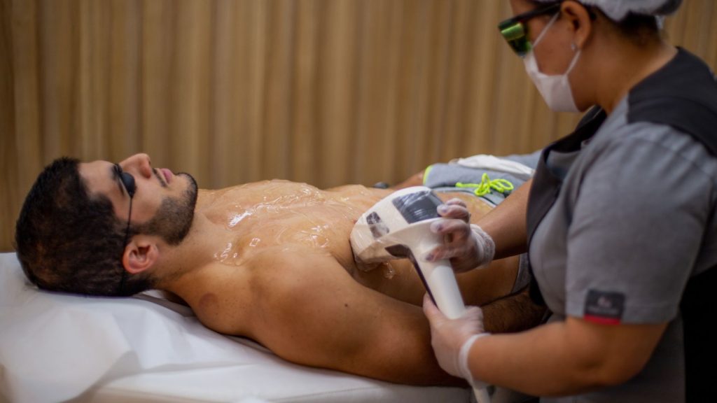 Profissional da Depyl Action realizando depilação a laser no peito de um homem