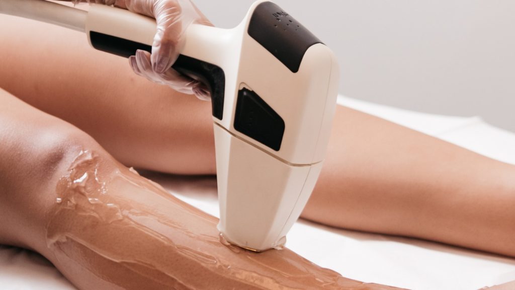 profissional aplicando depilação a laser em cliente