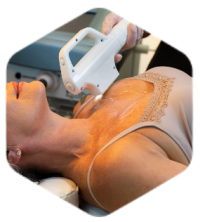 Tratamento Luz Pulsada Depyl Action